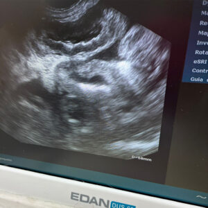 Medizintopf Podenco Panete, 11/2018, ca. 45 cm